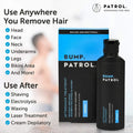 Bump Patrol Aftershave Treatment - 57ml by Aunty Cherish | Pre - stretched Braiding Hair Extensions Australia